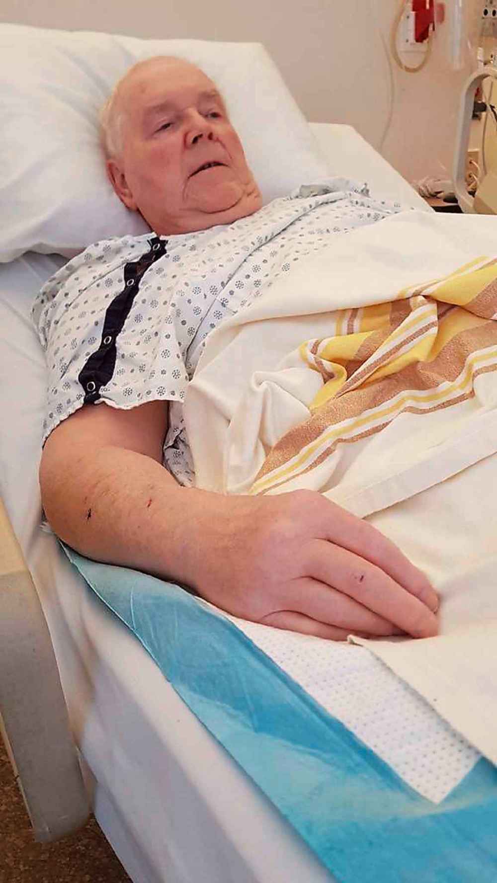 SUPPLIED
George Myer received a CT scan and MRI in mid-September that showed a growth on the upper lobe of his right lung.