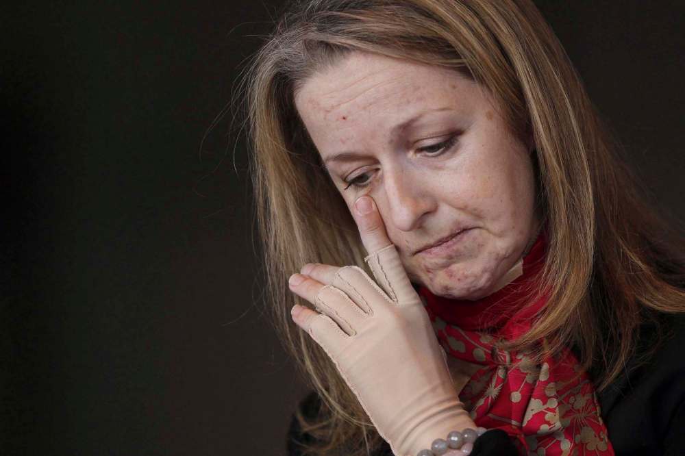 Lawyer Maria Mitousis at a press conference in 2015. She has returned to work full-time, has endured hours of rehabilitation and still deals with a constant throbbing pain in her residual limb, she told court Wednesday. (John Woods / The Canadian Press files)