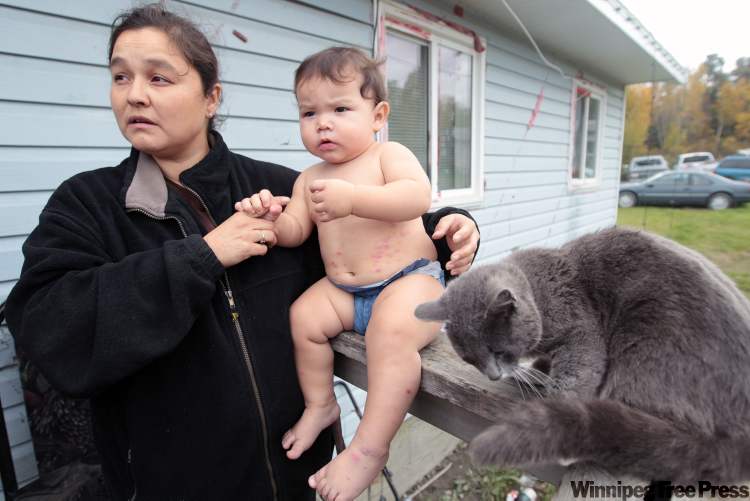 JOE.BRYKSA@FREEPRESS.MB.CA
Grandmother Shayle Moneyas with grandchild Xavier. A doctor said the baby’s impetigo skin condition is probably not related to the contaminated water flowing through Hollow Water’s taps, but Moneyas sometimes gets stomach cramps from drinking it.