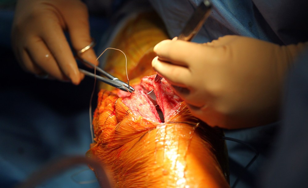 Canadians can pay for a medical procedure as long as they travel to another province to have it done. (Phil Hossack / Winnipeg Free Press files)