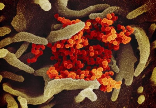 This undated electron microscope image made available by the U.S. National Institutes of Health in February 2020 shows the Novel Coronavirus SARS-CoV-2, orange, emerging from the surface of cells, green, cultured in the lab. Also known as 2019-nCoV, the virus causes COVID-19. (NIAID-RML via AP)
