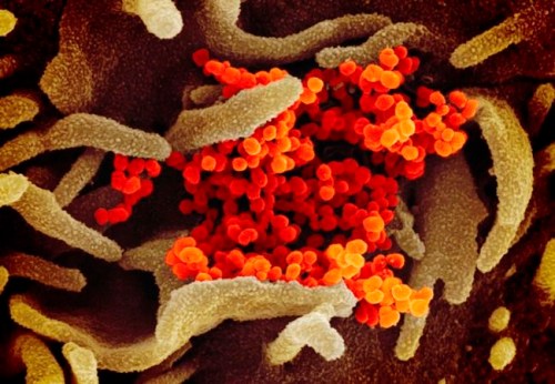 This undated electron microscope image made available by the U.S. National Institutes of Health in February 2020 shows the Novel Coronavirus SARS-CoV-2, orange, emerging from the surface of cells, green, cultured in the lab. Also known as 2019-nCoV, the virus causes COVID-19. The sample was isolated from a patient in the U.S. (NIAID-RML via AP)