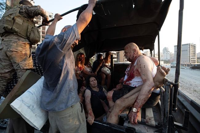 Injrued are evacuated after a massive explosion in Beirut, Lebanon, Tuesday, Aug. 4, 2020. Massive explosions rocked downtown Beirut on Tuesday, flattening much of the port, damaging buildings and blowing out windows and doors as a giant mushroom cloud rose above the capital. Witnesses saw many people injured by flying glass and debris. (AP Photo/Hassan Ammar)