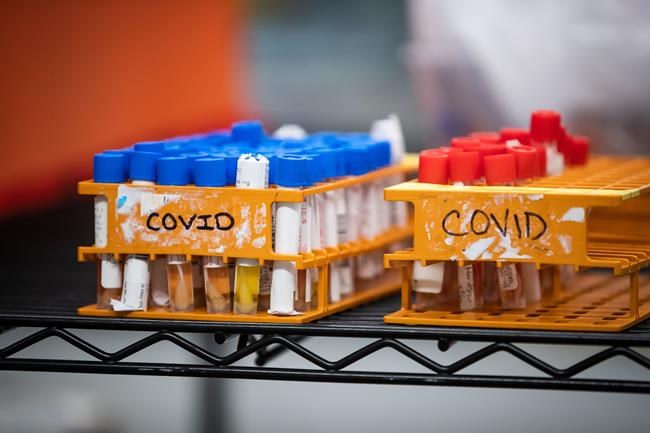 Specimens to be tested for COVID-19 are seen at LifeLabs after being logged upon receipt at the company's lab, in Surrey, B.C., Thursday, March 26, 2020. A trio of federal cabinet minister is warning COVID-19 researchers to take additional precautions to protect their efforts from those with nefarious intentions. THE CANADIAN PRESS/Darryl Dyck