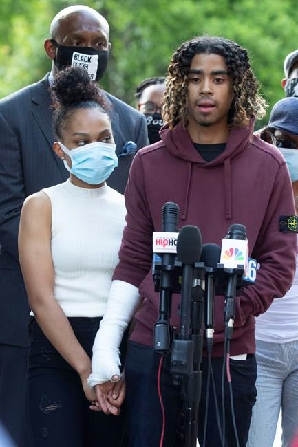 Taniyah Pilgrim holds Messiah Young's bandaged hand as he speaks during a news conference on the campus of Morehouse College Monday, June 1, 2020, in Atlanta. Two Atlanta police officers have been fired and three others placed on desk duty over excessive use of force during a protest arrest incident involving the two college students, Atlanta's mayor said. (AP Photo/John Bazemore)