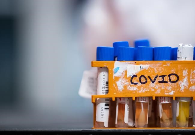 Specimens to be tested for COVID-19 are seen at LifeLabs after being logged upon receipt at the company's lab, in Surrey, B.C., on Thursday, March 26, 2020. The federal government has a deal with a third vaccine developer to get access to their experimental COVID-19 vaccine as early as next spring. THE CANADIAN PRESS/Darryl Dyck