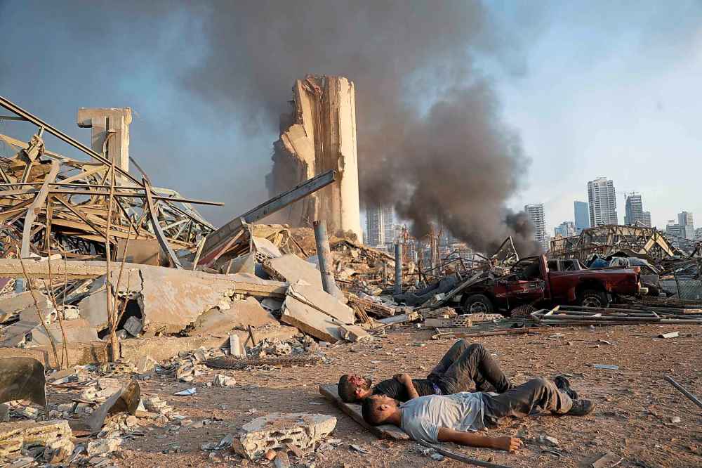 Two injured men lie on the ground, waiting for help at the explosion scene that hit the seaport, in Beirut Lebanon, Tuesday, Aug. 4, 2020. (AP Photo/Hussein Malla)