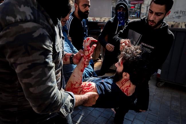 Anti-government protesters help a friend wounded during a scuffle with Lebanese army soldiers after the protesters tried to destroy bank windows during May Day protests near the Lebanese Central Bank in Beirut, Lebanon, Friday, May 1, 2020. Hundreds rallied outside the country's central bank and in other parts of the country a day after the prime minister said he'll be seeking a rescue program from the International Monetary Fund to deal with a spiraling economic crisis. (AP Photo/Hassan Ammar)
