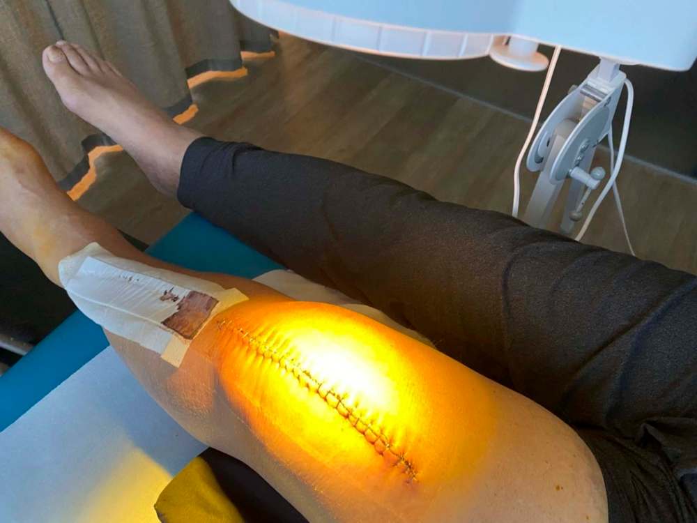 SUPPLIED
Johnson undergoing light therapy at the Nordorthopaedics Clinic in Lithuania.