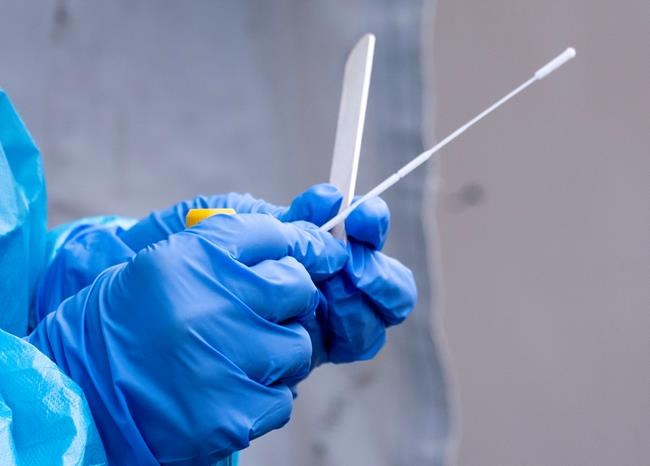 A nurse gets a swab ready at a temporary COVID-19 test clinic in Montreal, on Friday, May 15, 2020. With students and teachers preparing to return to classrooms across the country this month, experts say ramping up testing protocols is one way to help provide a safe transition back to school.Some epidemiologists believe testing a group of COVID nasal-swab samples together — a strategy known as pooled testing or batch testing — might be a more efficient method for dealing with a large number of tests that could potentially be coming in. THE CANADIAN PRESS/Paul Chiasson