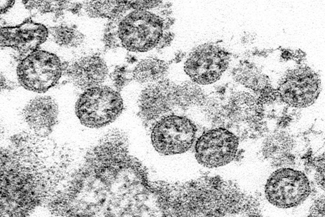 This 2020 electron microscope made available by the U.S. Centers for Disease Control and Prevention image shows the spherical coronavirus particles from the first U.S. case of COVID-19. A recent study sparked some worry last week when it revealed a mutation