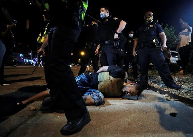 A protestor winces in pain after being pepper sprayed by Memphis police during a protest over the death of George Floyd, Thursday, May 28, 2020, in Memphis, Tenn. (Patrick Lantrip/Daily Memphian via AP)