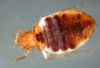 CNS
Cimex lectularius OR bed bug - Photo Courtesy Postmedia.   FOR POSTMEDIA WEEKLY FEATURES PACKAGE NOVEMBER 22, 2010.  For Jeff Heinrich (Montreal Gazette).  FEAT-BEDBUGS