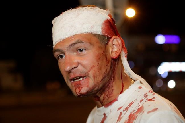 A man wounded during clashes with police speaks to people during a mass protest following presidential elections in Minsk, Belarus, Monday, Aug. 10, 2020. Thousands of people have protested in Belarus for a second straight night after official results from weekend elections gave an overwhelming victory to authoritarian President Alexander Lukashenko, extending his 26-year rule. A heavy police contingent blocked central squares and avenues, moving quickly to disperse protesters and detained dozens. (AP Photo/Sergei Grits)