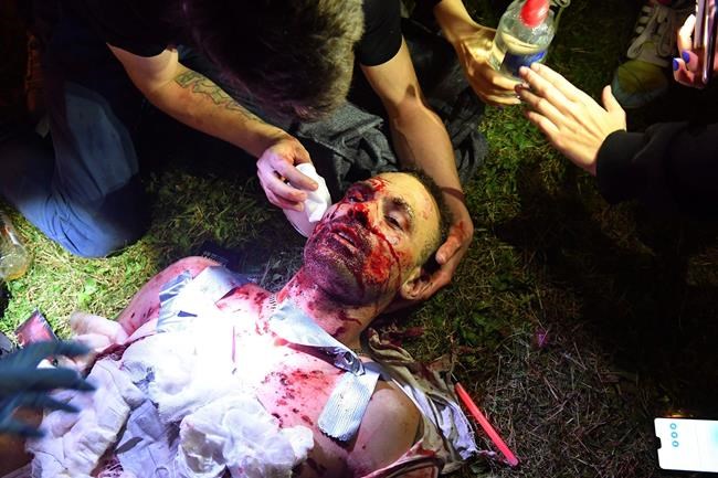 Protesters give a first aid to a wounded man, injured by shrapnel from a smoke grenade, during clashes with police after the Belarusian presidential election in Minsk, Belarus, late Sunday, Aug. 9, 2020. Police and protesters clashed in Belarus' capital and the major city of Brest on Sunday after the presidential election in which the authoritarian leader who has ruled for a quarter-century sought a sixth term in office. (AP Photo)