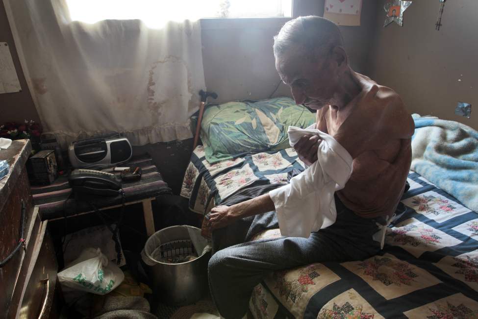 JOE BRYKSA/WINNIPEG FREE PRESS
NO RUNNING WATER FEATURE
- Elder Zach Harper in his home in St.Theresa Point First Nation. He shows his scars from operations from his fight with tuberculosis. For years, the family has lived with no running water. July 2010