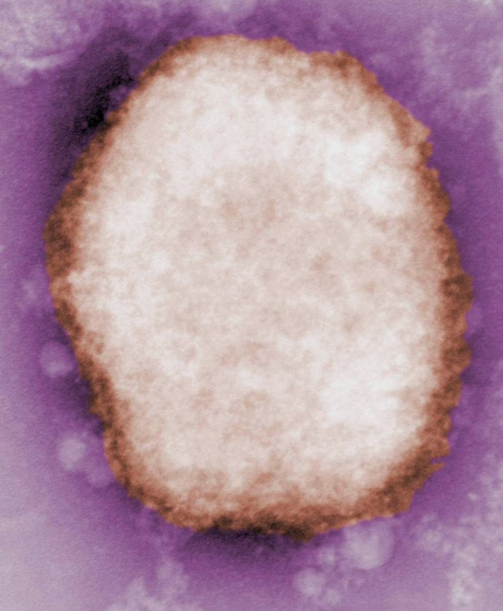 CDC PHOTOA negative stain electron micrograph reveals a monkeypox virus virion in human vesicular fluid.