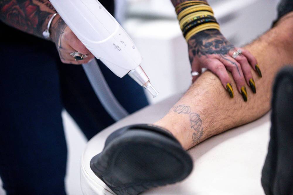 The laser machine Steinke uses to remove tattoos. (Mikaela MacKenzie / Winnipeg Free Press)