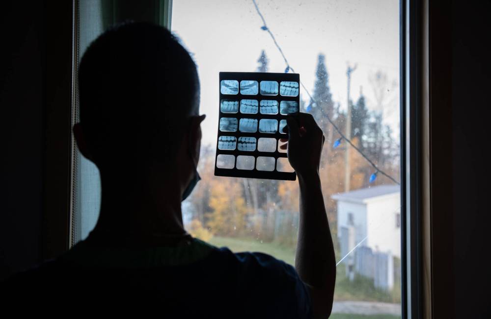 JESSICA LEE / WINNIPEG FREE PRESS
Mah checks X-rays by window light. While the power is down, he still prepares for a scenario where he can use a full array of dental tools.