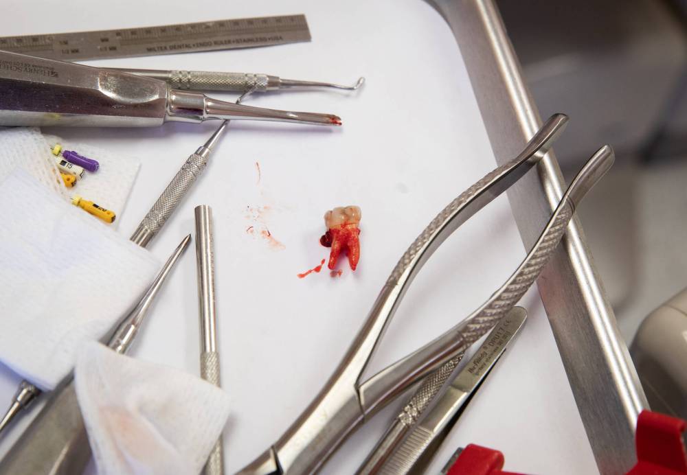JESSICA LEE / WINNIPEG FREE PRESS
Ruby’s tooth is not the only tooth to be pulled out. Wally does three more extractions that day. Ruby’s tooth is photographed after it is removed.