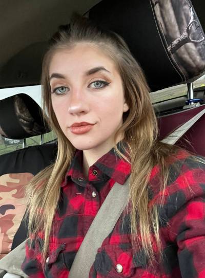 SUPPLIED
                                Virginia Blatz died from local anesthetic systemic toxicity caused by an inadvertent injection into a blood vessel in 2024.